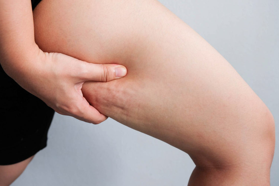 dieta cellulite